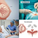 Tout savoir sur la mammectomie : techniques, indications et suivi sans aucun texte