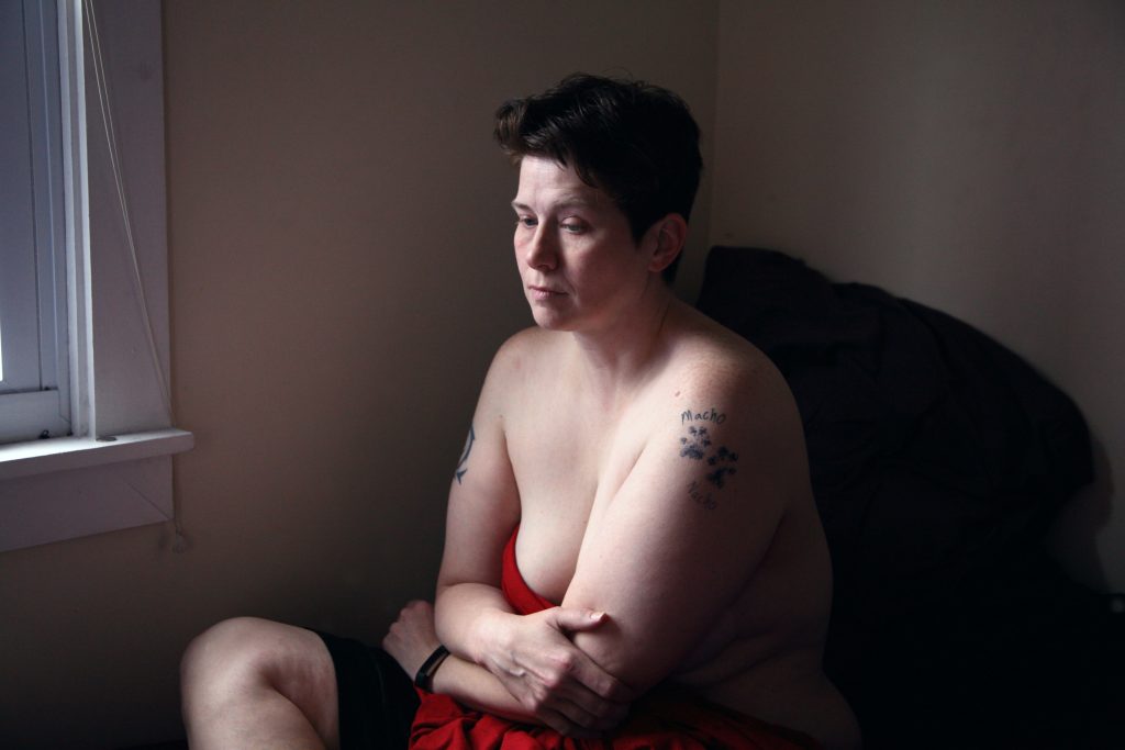 Transformation transmasculine : chirurgie, testostérone et photos avant/après without any text