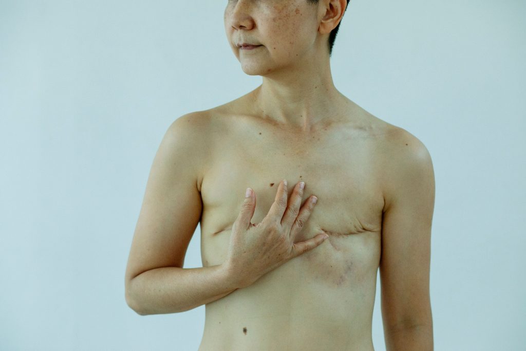 Transformation transmasculine : chirurgie, testostérone et photos avant/après (sans texte)